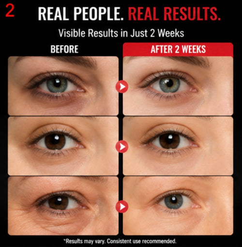 RevitaEyes™ Red Light Therapy Eye Patches